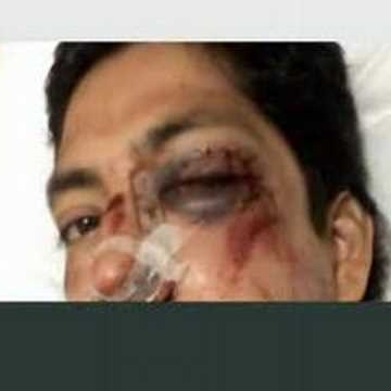 Tito Aguilar Photo 20