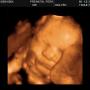 Alicia Foster Photo 18
