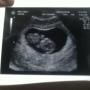 Emily Conley Photo 29